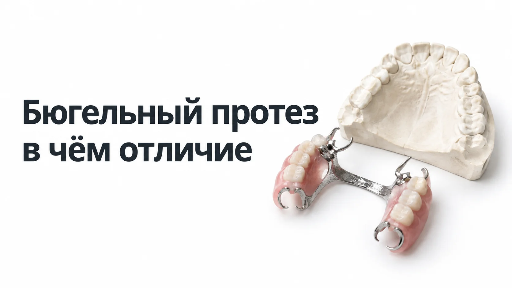 Бюгельный протез на металлическом каркасе с кламмерами рядом с гипсовой моделью челюсти