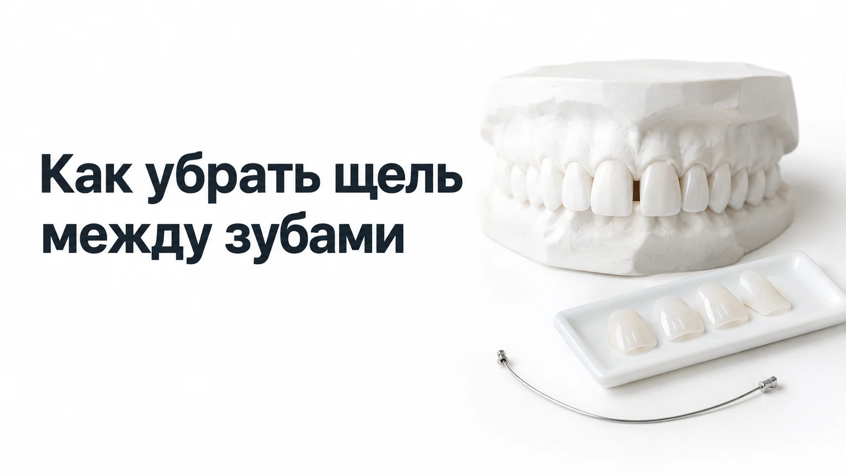 Гипсовая модель челюстей со щелью между верхними центральными резцами, рядом лоток с керамическими винирами и ортодонтическая дуга