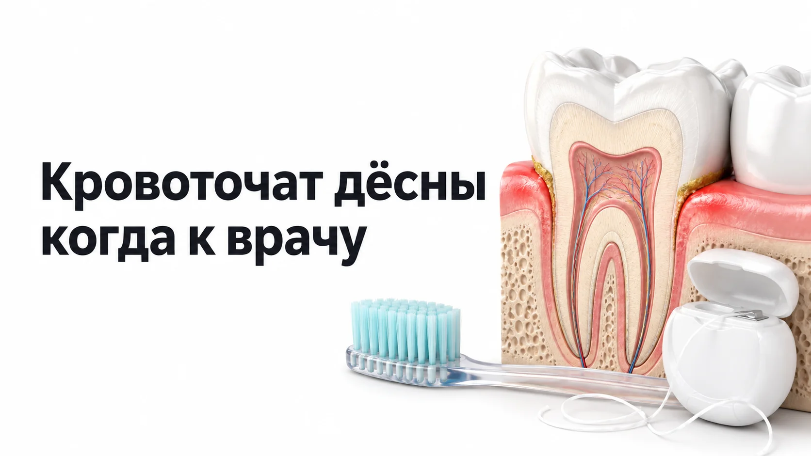 Разрез зуба с покрасневшим краем десны и налётом у шейки, рядом мягкая зубная щётка и зубная нить