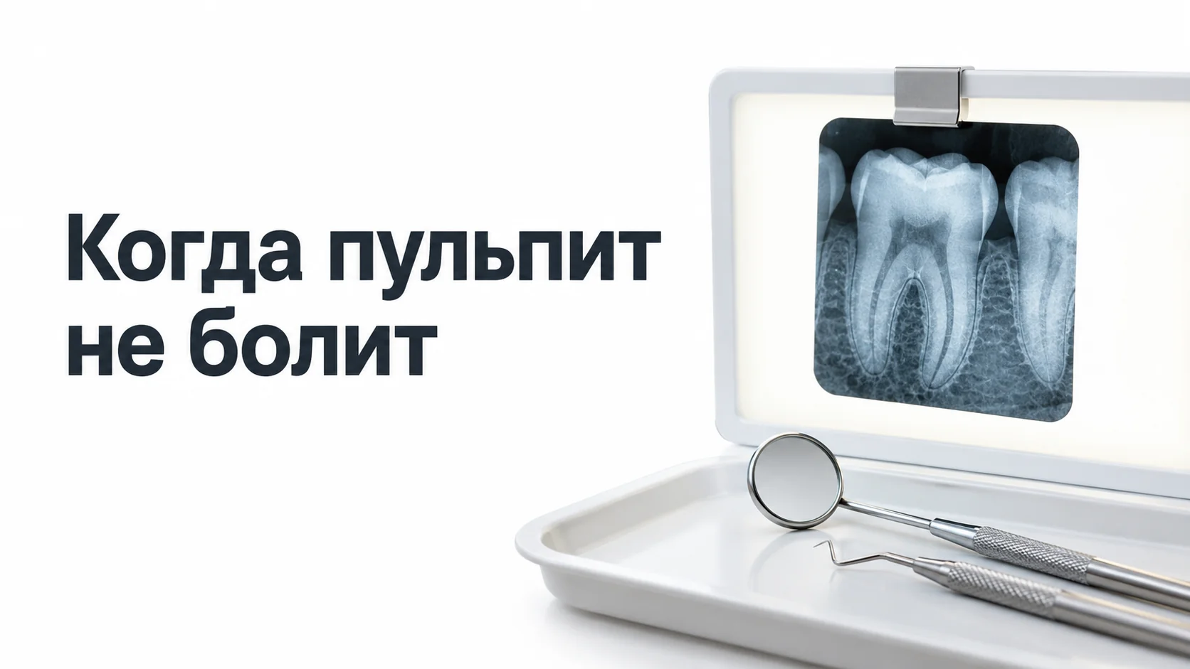 Прицельный рентгеновский снимок моляра на подсвеченном негатоскопе, рядом стоматологическое зеркало и зонд на лотке