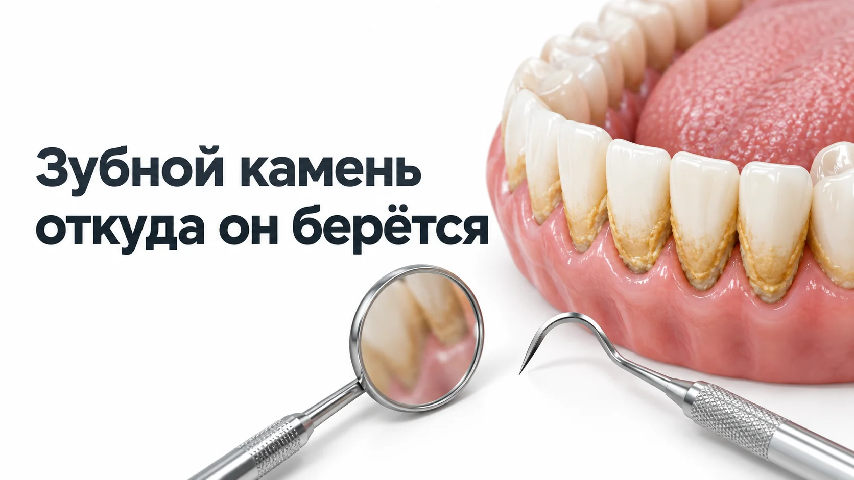 Модель нижней челюсти с желтоватым зубным камнем у края десны, рядом стоматологическое зеркало и зонд